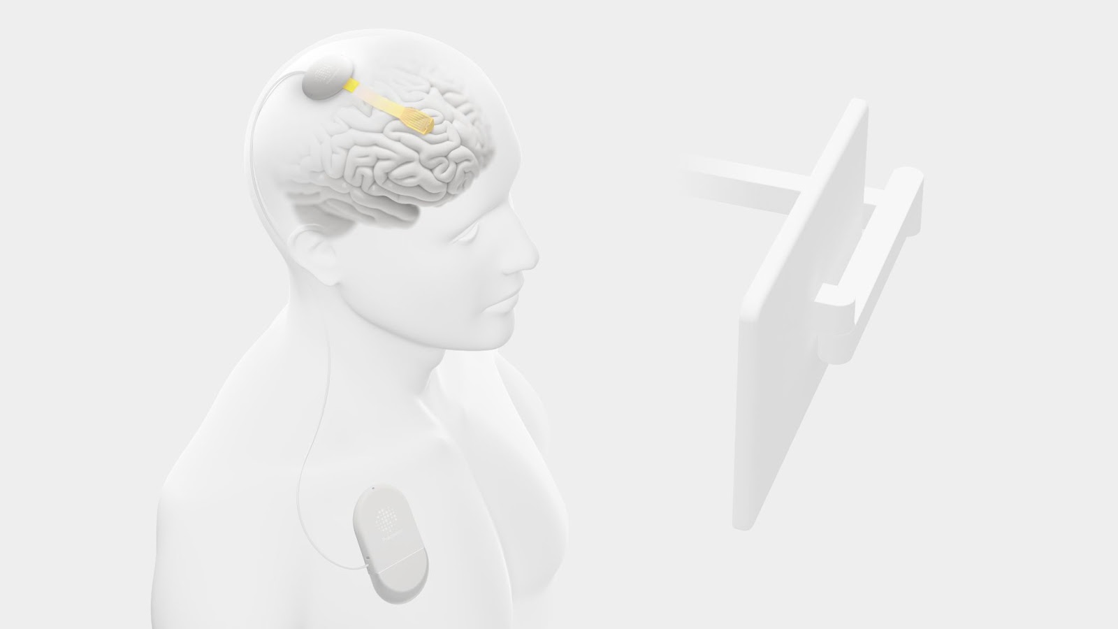 A diagram shows a person with a brain implant connected to a device on their chest, facing a screen, illustrating a neural interface system.